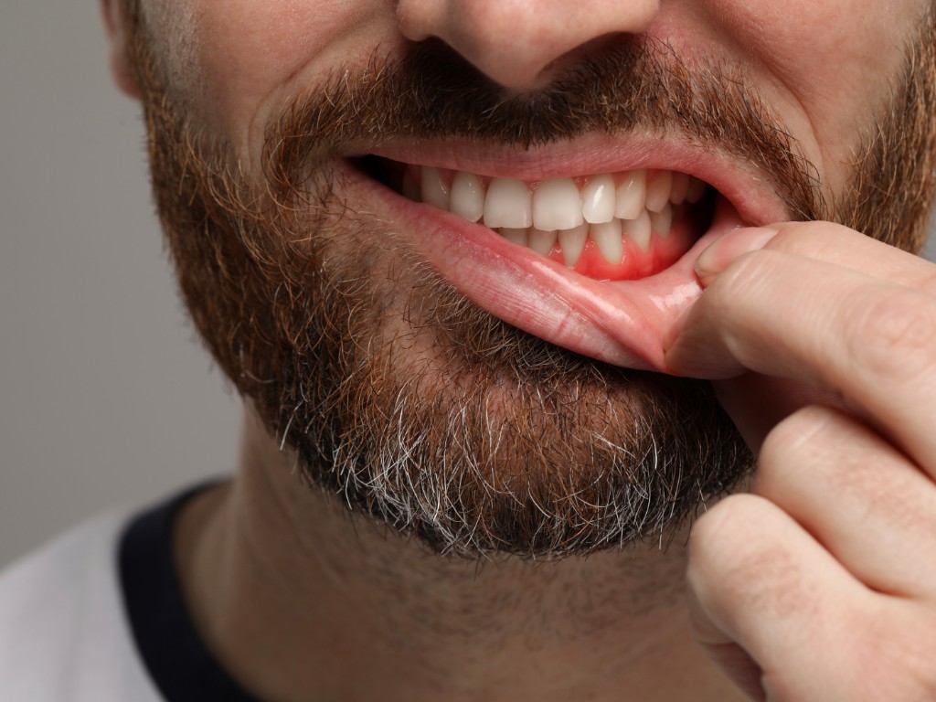 Scopri perché i denti diventano sensibili, quali rimedi usare ogni giorno e quando è il momento di farti visitare da un dentista. Guida completa con consigli pratici.